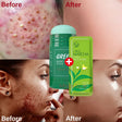 Green Tea Repair Acne Mud Mask - Picksentials