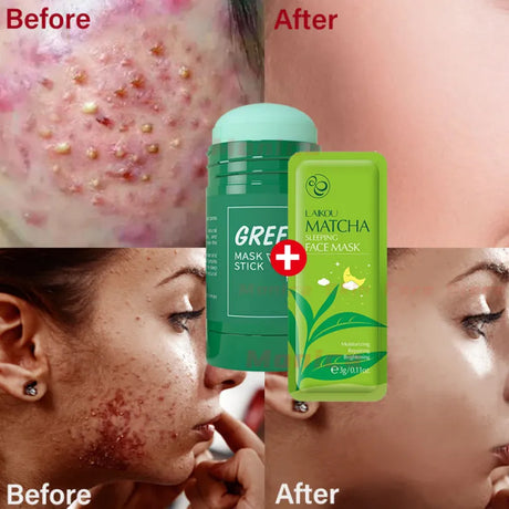 Green Tea Repair Acne Mud Mask - Picksentials