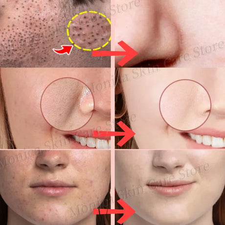 Green Tea Repair Acne Mud Mask - Picksentials